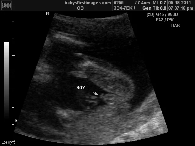 Baby Sutton is a Boy Baby Sutton is a Boy