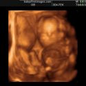 The Moment Of Truth: Finding Out The Sex Of Our Baby!