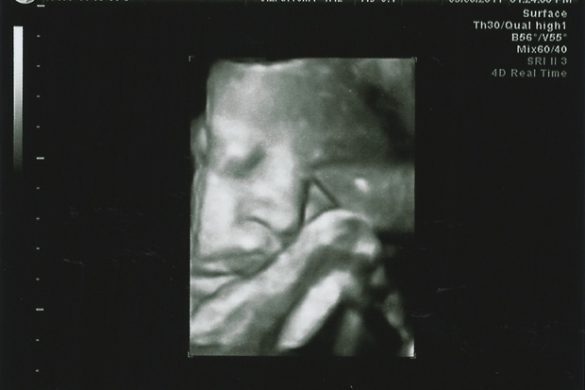 Daniel 36 Week Ultrasound